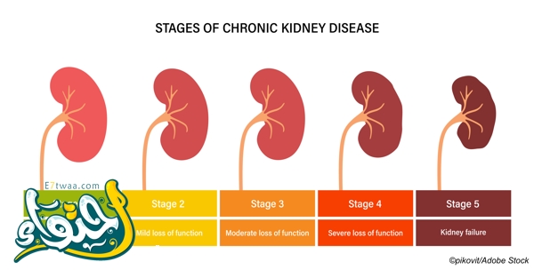 Blood in urine: causes and when should we worry? 