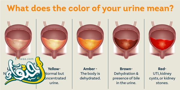 Blood in urine: causes and when should we worry? 